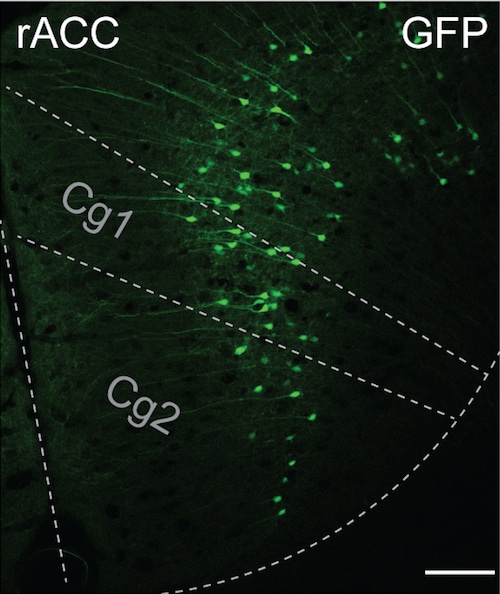 rACC neural circuit pathway